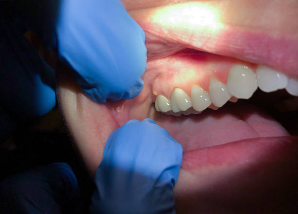 Best Same-Day Emergency Dentist in Sinton, TX